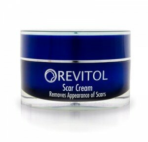 Revitol Scar Cream Review